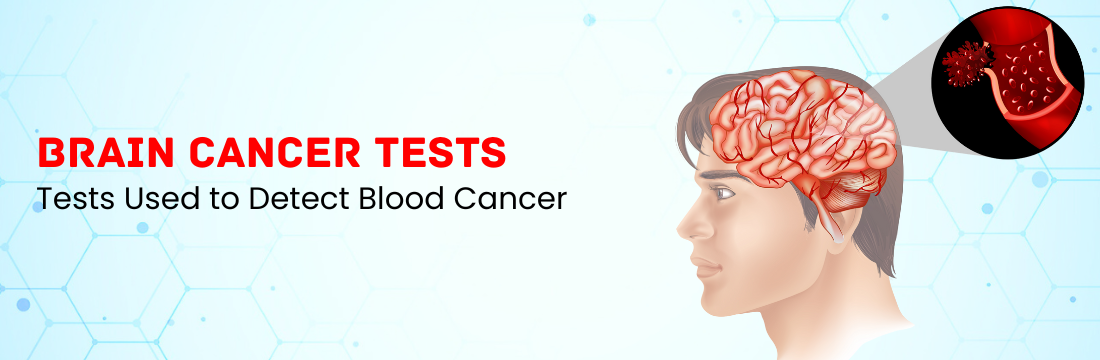 What Are the Tests Used to Detect the Brain Cancer?